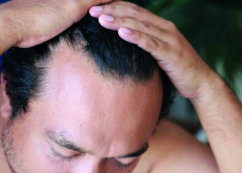 97% natural support against hair loss