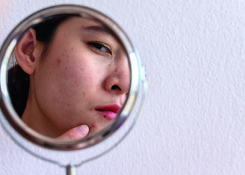 The skincare trend trap