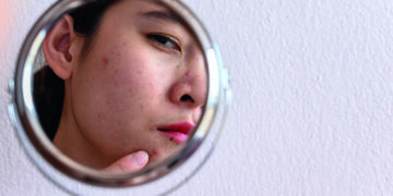 The skincare trend trap